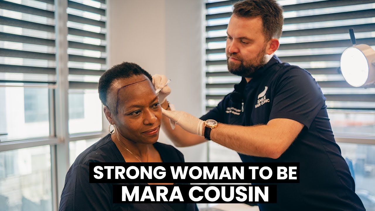 FEMALE AFRO HAIR TRANSPLANT | STRONG WOMAN TO BE MARA COUSIN |  | DR.MEHMET ERDOGAN | 2820 GRAFTS