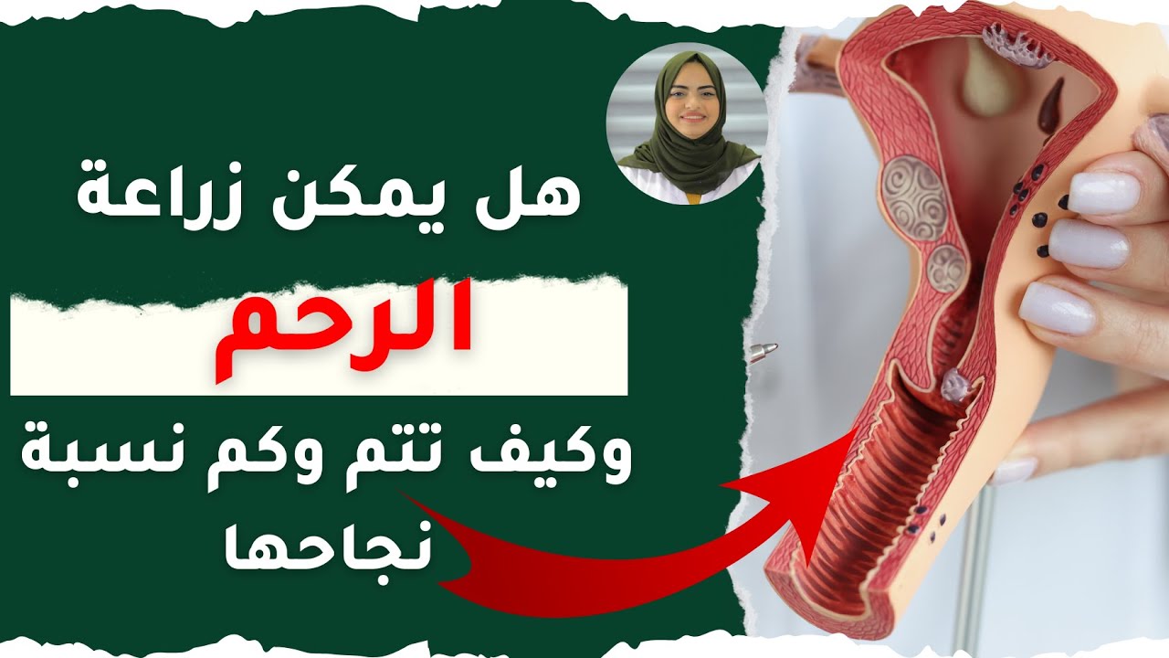 هل يمكن زراعة الرحم وكيف تتم وكم نسبة نجاحها