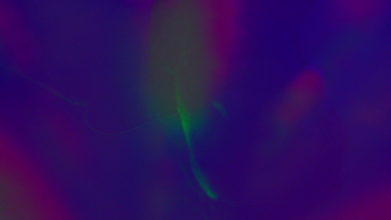 THE DRY MOUTHS - La Mascotta (Official Video)