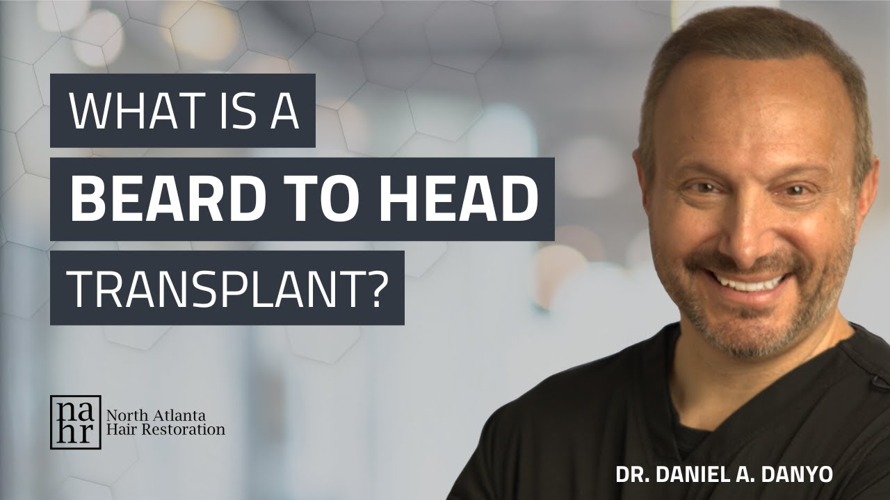 What is a Beard to Head Transplant?