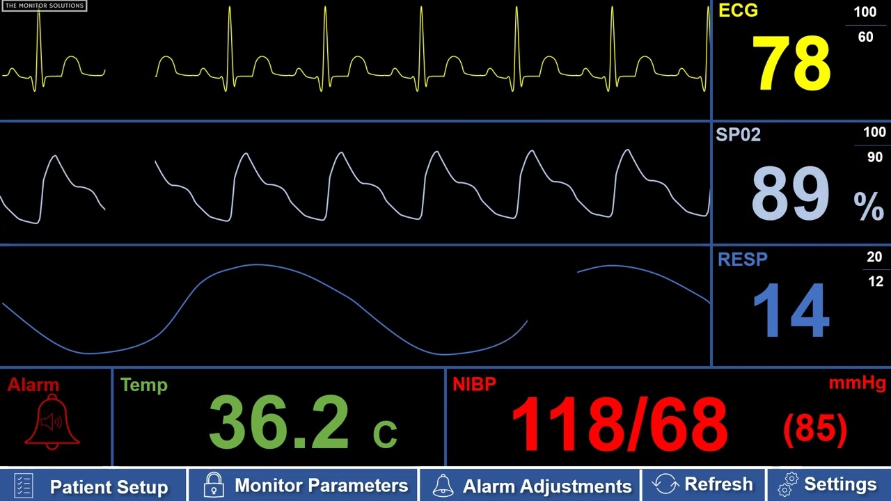 Simulated Adult Patient Monitor – Low Pulse Ox