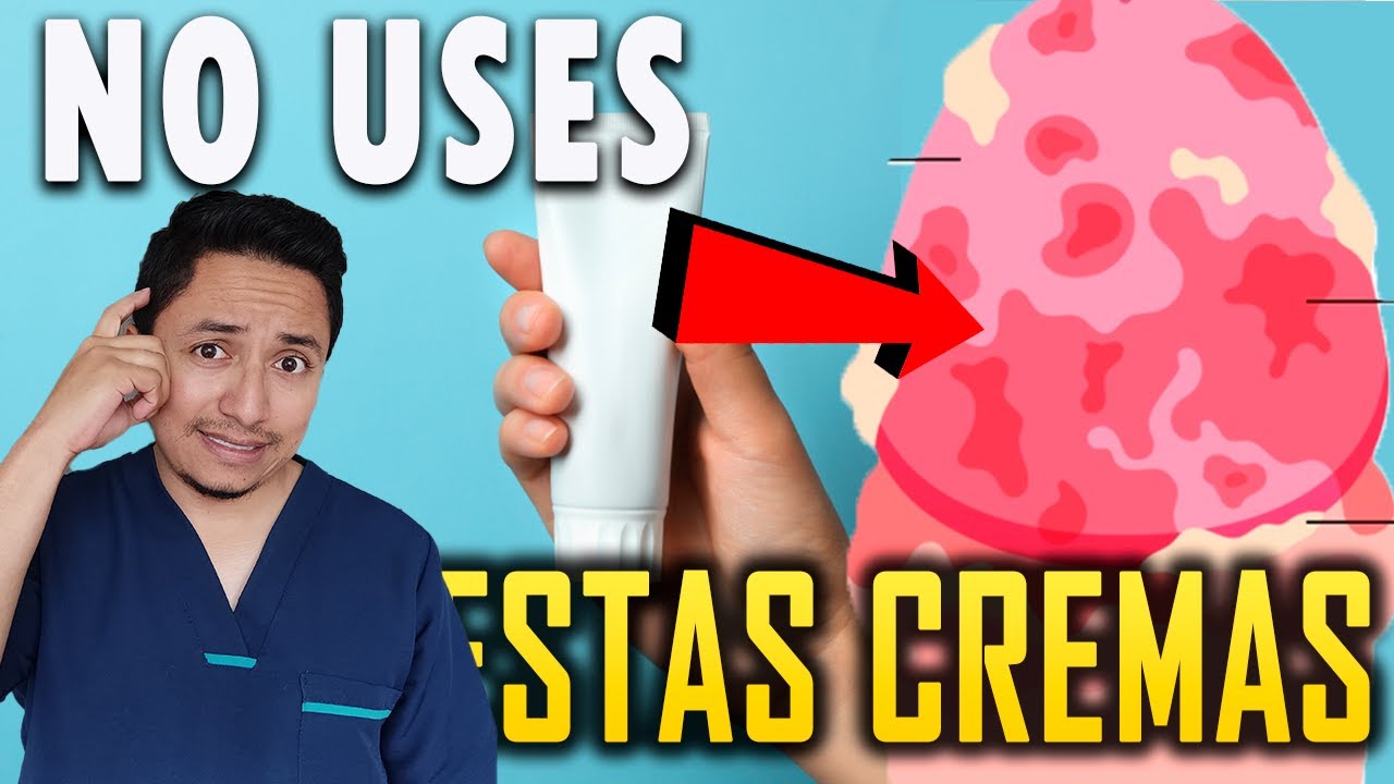 Las peores Cremas que estas Usando para Curar la Inflamaci&oacute;n del Glande