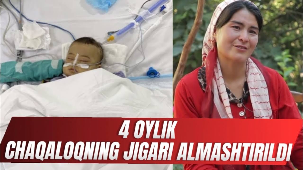 4 OYLIK CHAQALOQNING JIGAR ALMASHTIRISH OPERATSIYASI QANDAY O’TDI? #jigaralmashtirish 