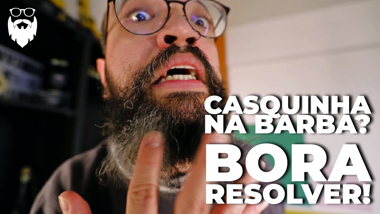 #BARBISTASBRASIL EP44: CASQUINHA NA BARBA? BORA RESOLVER!