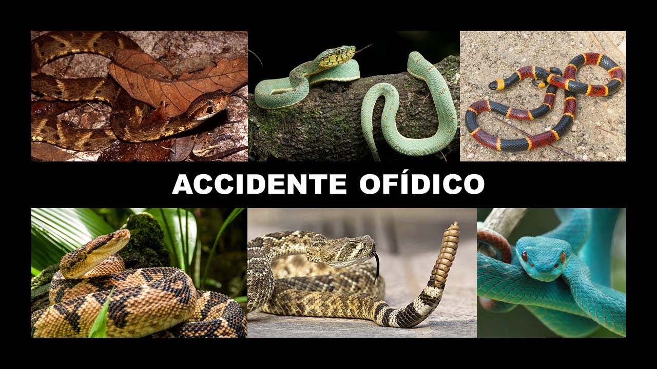 ACCIDENTE OFÍDICO – INFECTOLOGÍA - PERÚ