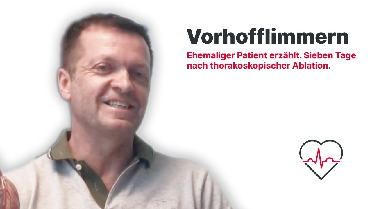 Hartnäckiges Vorhofflimmern: Ehemaliger Patient erzählt | 7 Tage nach Thorakoskopischer Ablation