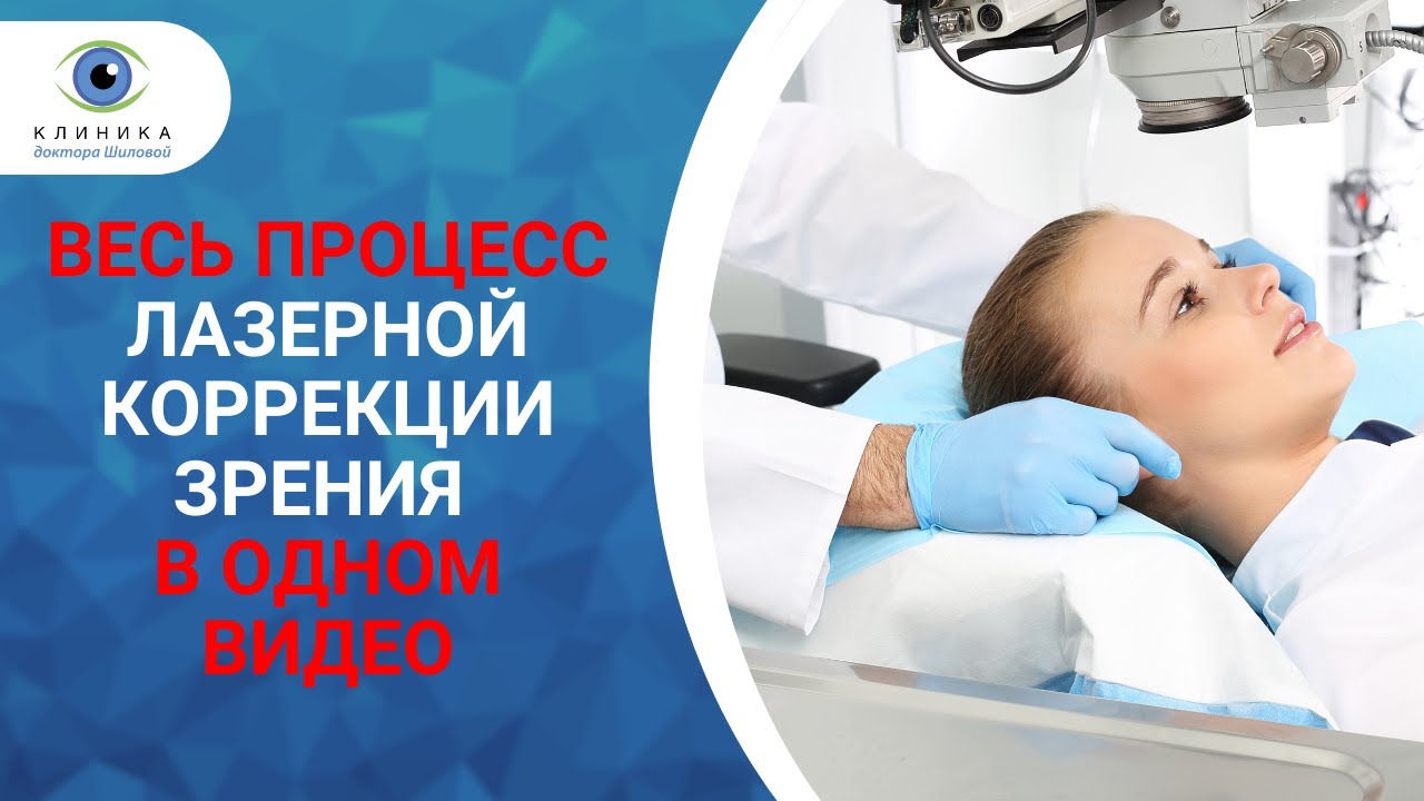 Как проходит лазерная коррекция зрения | Весь процесс &mdash; в одном видео