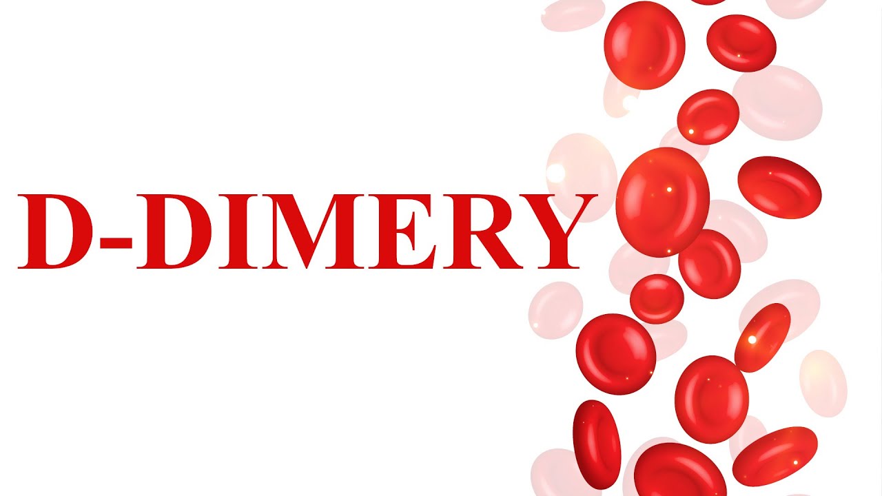 D-dimery Badanie.  Co to jest badanie krwi d-dimer&oacute;w? Cena. Stan zapalny. Podwyższone. Jak obniżyć.