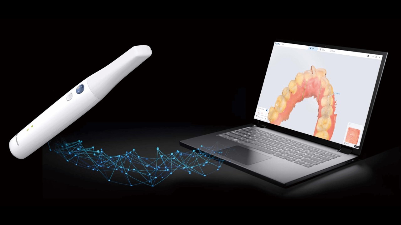 GDO presenta Escanner Intraoral Alliedstar Sensa
