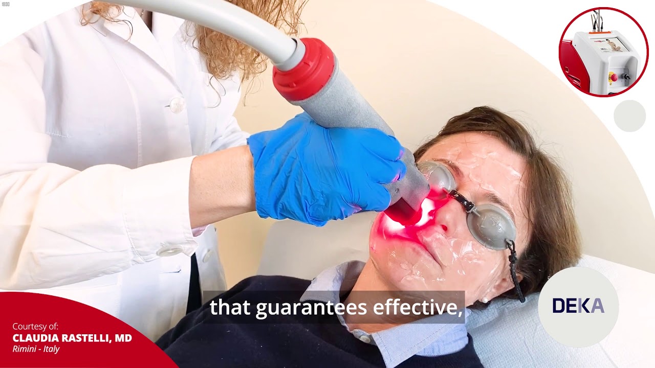 RedTouch by DEKA - an interesting evidence by Claudia Rastelli, MD