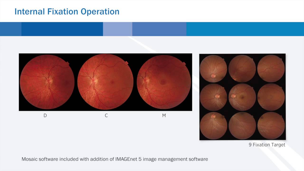 The Topcon TRC NW400 Retinal Camera