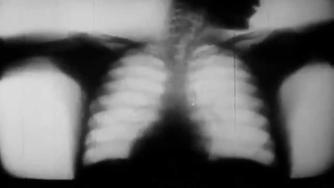 Broadcast - Corporeal