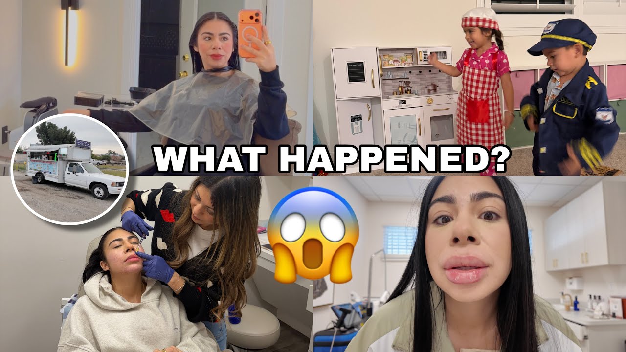 WHAT HAPPENED TO ME ? 😱