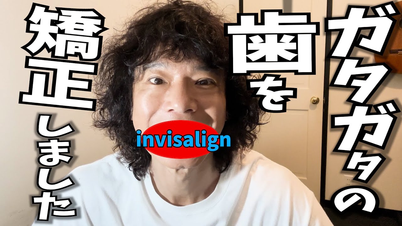 【歯列矯正】マウスピース矯正やってました！【before afterで見る歯並び】
