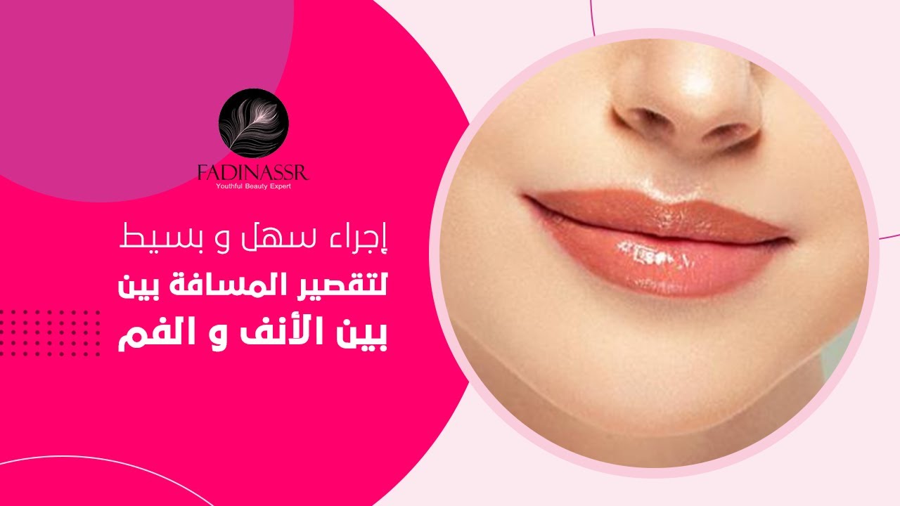 إجراء سهل وبسيط لتقصير المسافة بين الأنف والفم