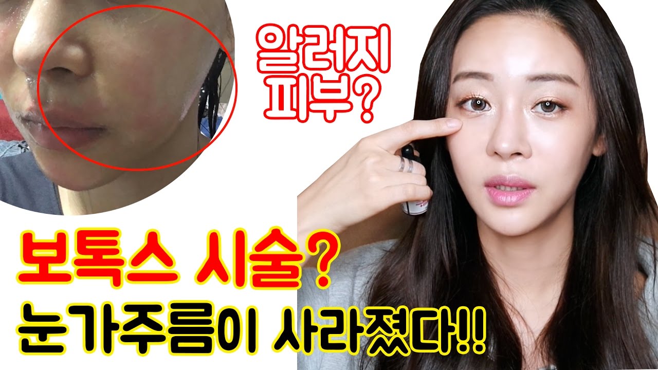 (ENG CC)민감성피부의 환절기스킨케어 루틴과 인생템 대방출(feat.좁쌀여드름)/Daily skin care