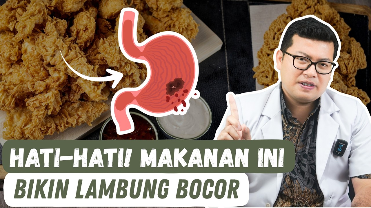 5 Makanan yang Bisa Memperparah Lambung Hingga Bocor! - DOKTER SADDAM ISMAIL