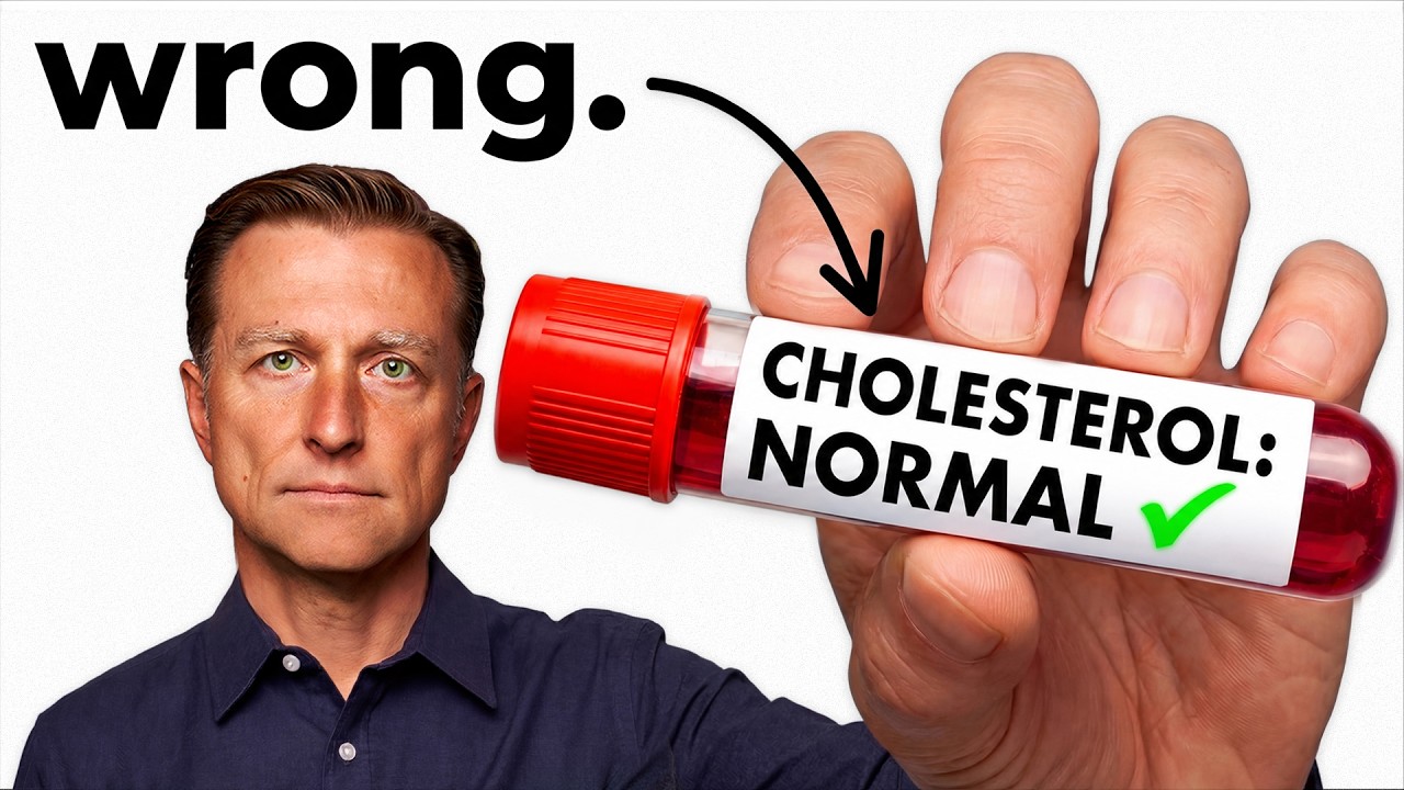 Jaki jest prawidłowy poziom cholesterolu (O czym nie m&oacute;wi Ci lekarz)