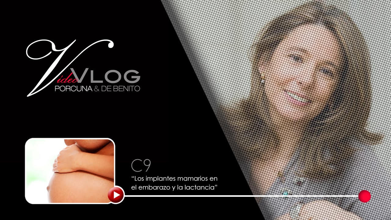 Capítulo 9 - Los implantes mamarios en el embarazo y la lactancia