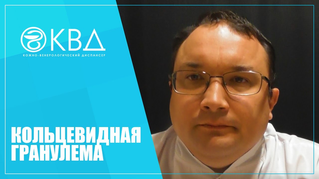 1384  Кольцевидная гранулема