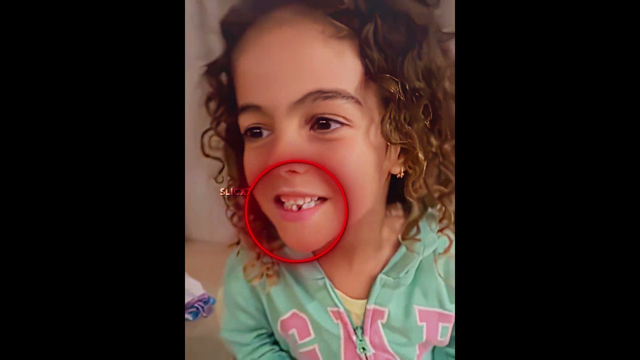Ronaldo's Tooth Prank to Alana 😂