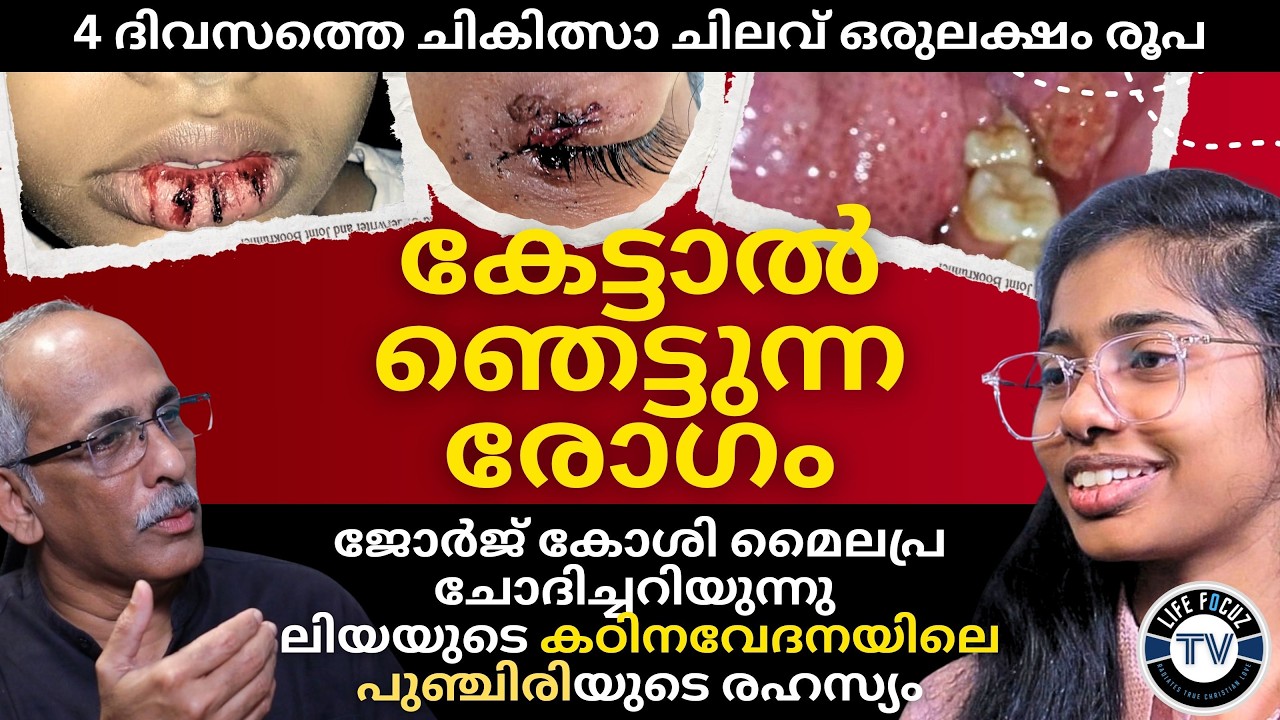 കഠിനവേദനയിലും നിറപുഞ്ചിരി | LIYAMOL U.G. | GEORGE KOSHY MYLAPRA