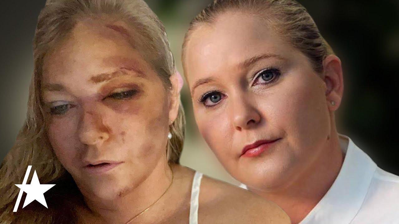 Jeffrey Epstein & Prince Andrew Accuser Virginia Giuffre Claims She Has Days To Live After Crash