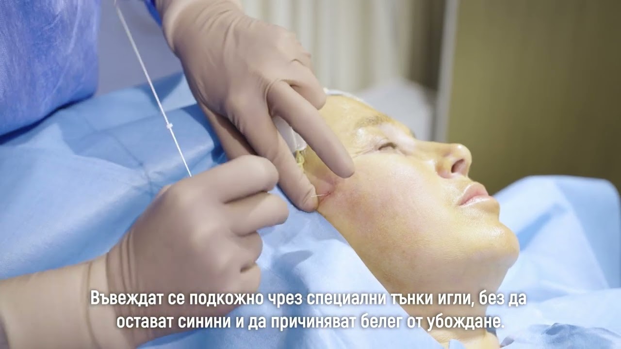Мезоконци - Лифтинг терапия