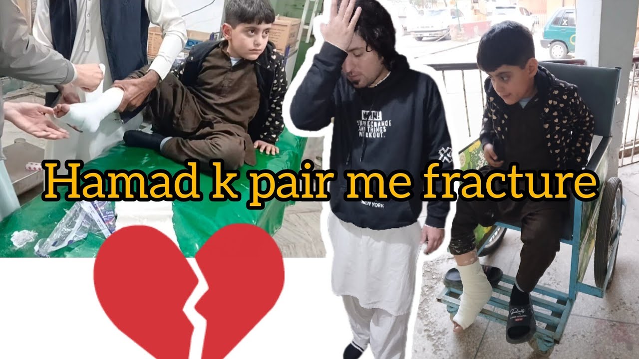 Hamad gir gaya pair me fracture ho gayie 😭💔  1 February 2026