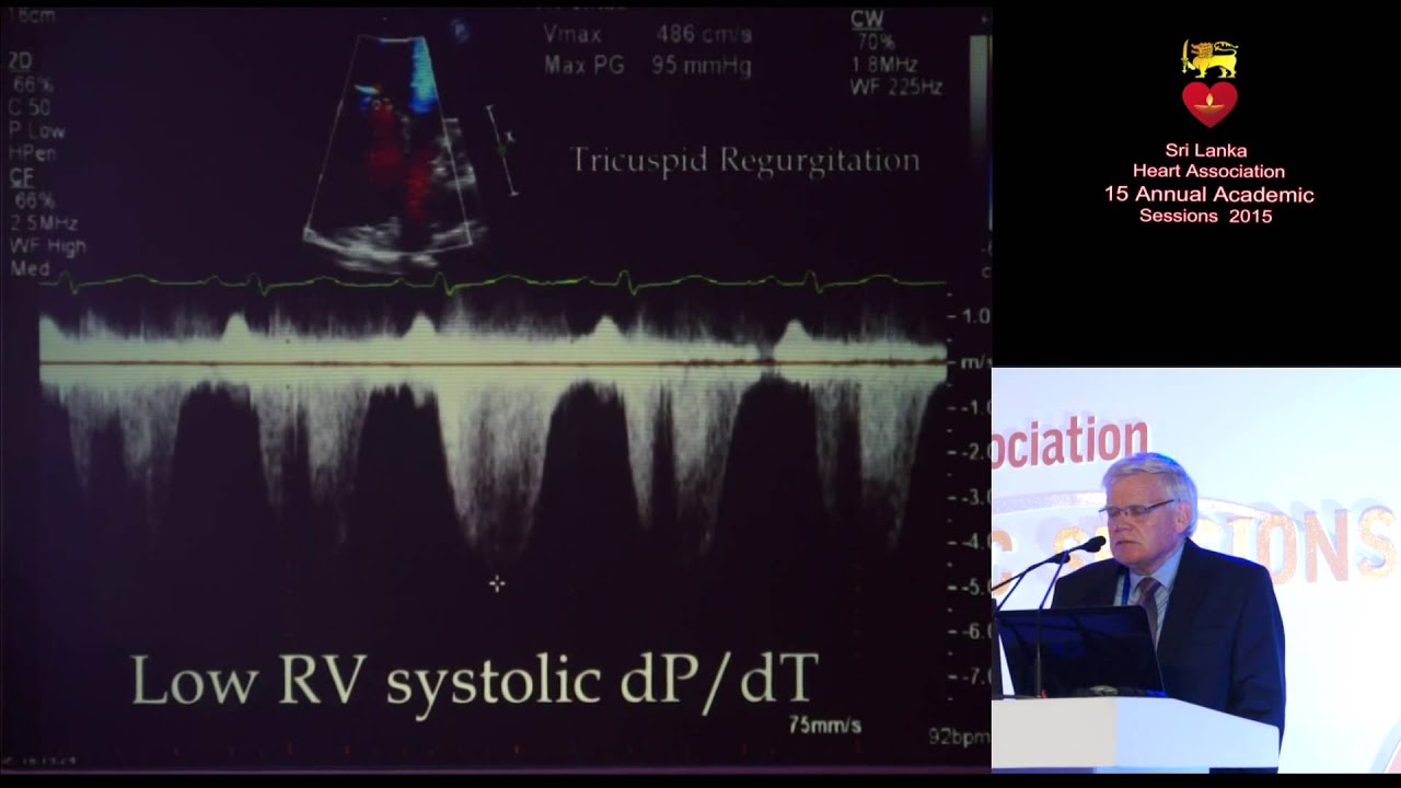2D Echo assessment of suspected Pulmonary Hypertension
