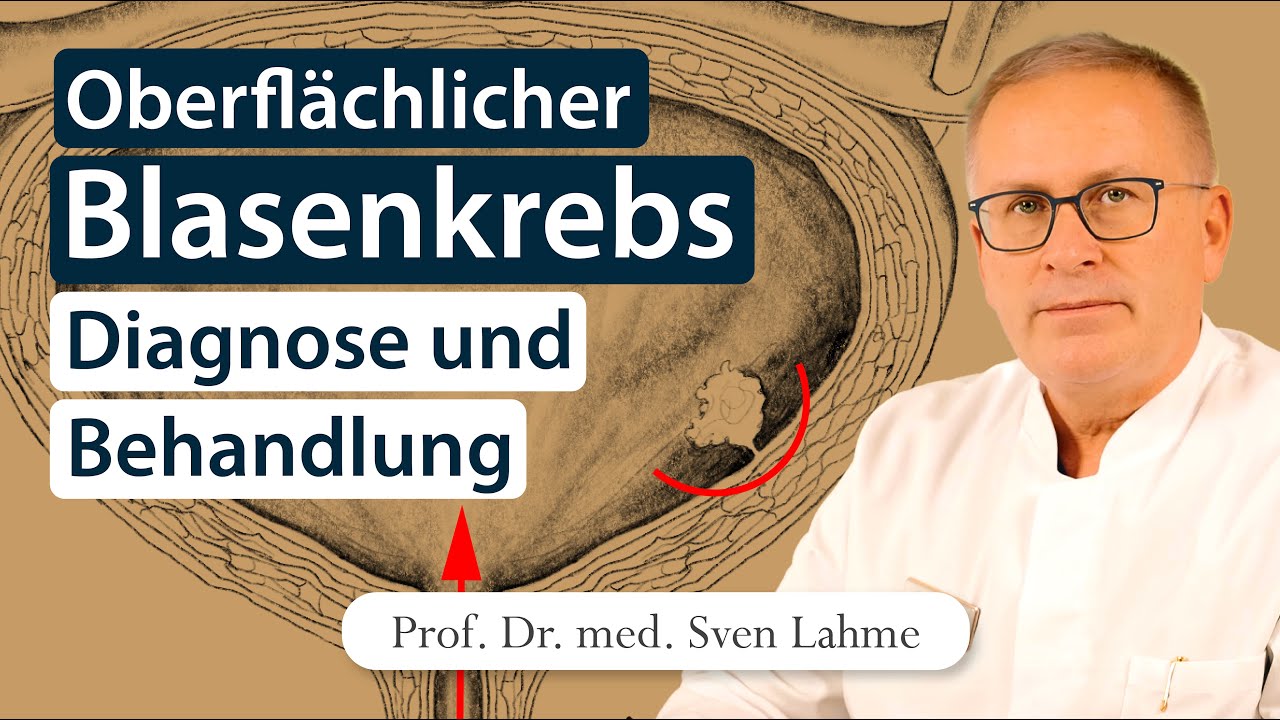 Was tun bei oberflächlichem Harnblasenkrebs | Urologie verständlich erklärt