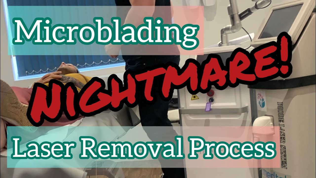 Microblading | Laser Removal Process | Nightmare!