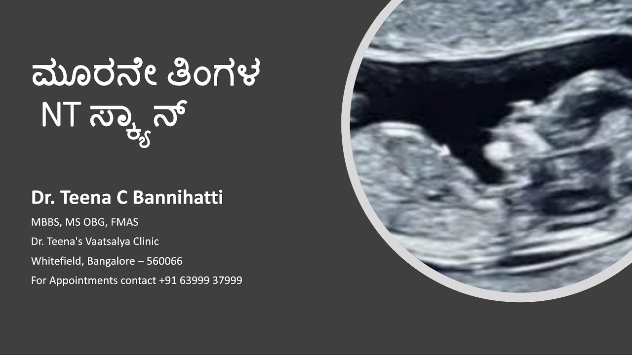 NT Scan in third month of Pregnancy ll ಮೂರನೇ ತಿಂಗಳ NT ಸ್ಕ್ಯಾನ್ ll Dr. Teena C Bannihatti