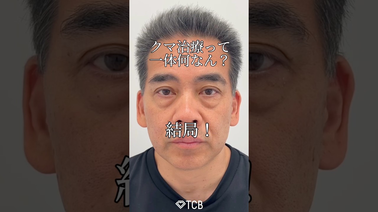 【クマ取り】クマ治療って一体何なん？#目の下のクマ取り #目の下のたるみ取り #目の下のふくらみ取り #目の下のクマ #TCB #shorts