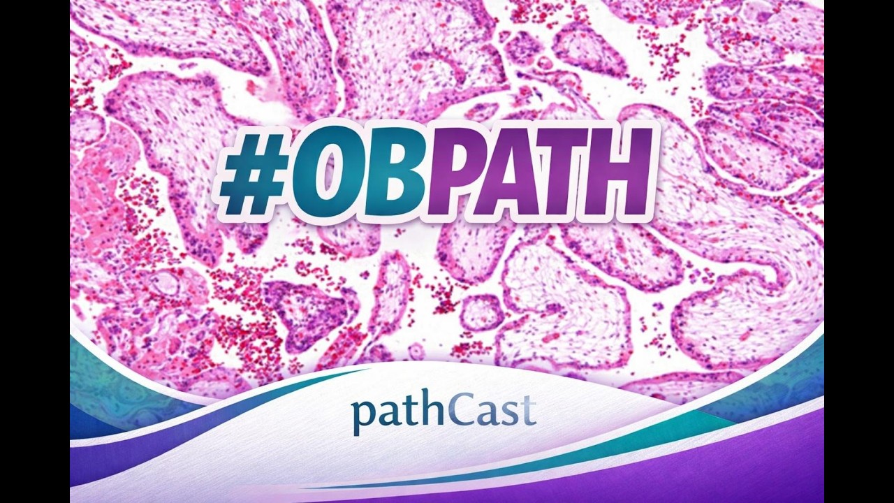Products of Conception: What not to Miss! - Dr. Torous (MGH) #OBPATH