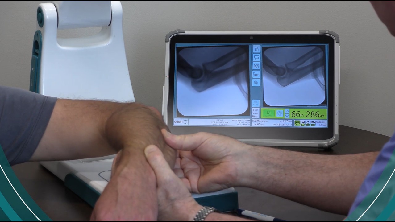 The Future of Pediatric Orthopedics: Dr. Herzenberg on the SMART-C mini c-arm