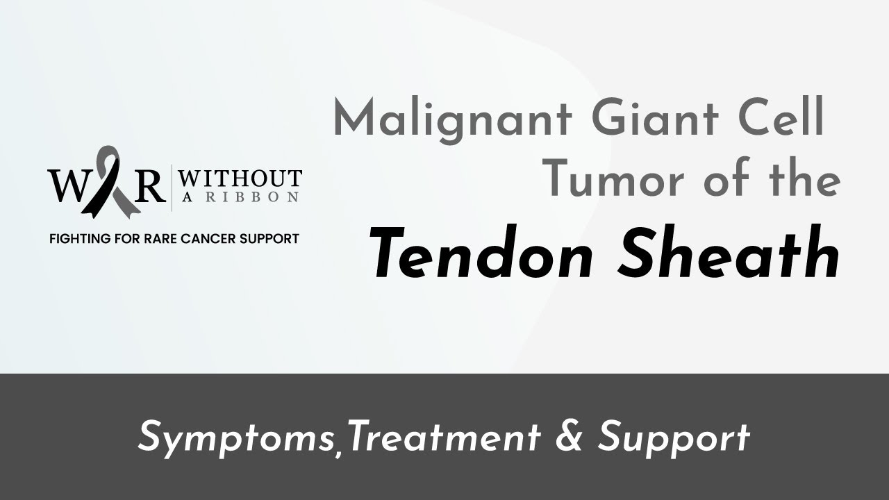 Malignant Giant Cell Tumour of The Tendon Sheath - Without a Ribbon