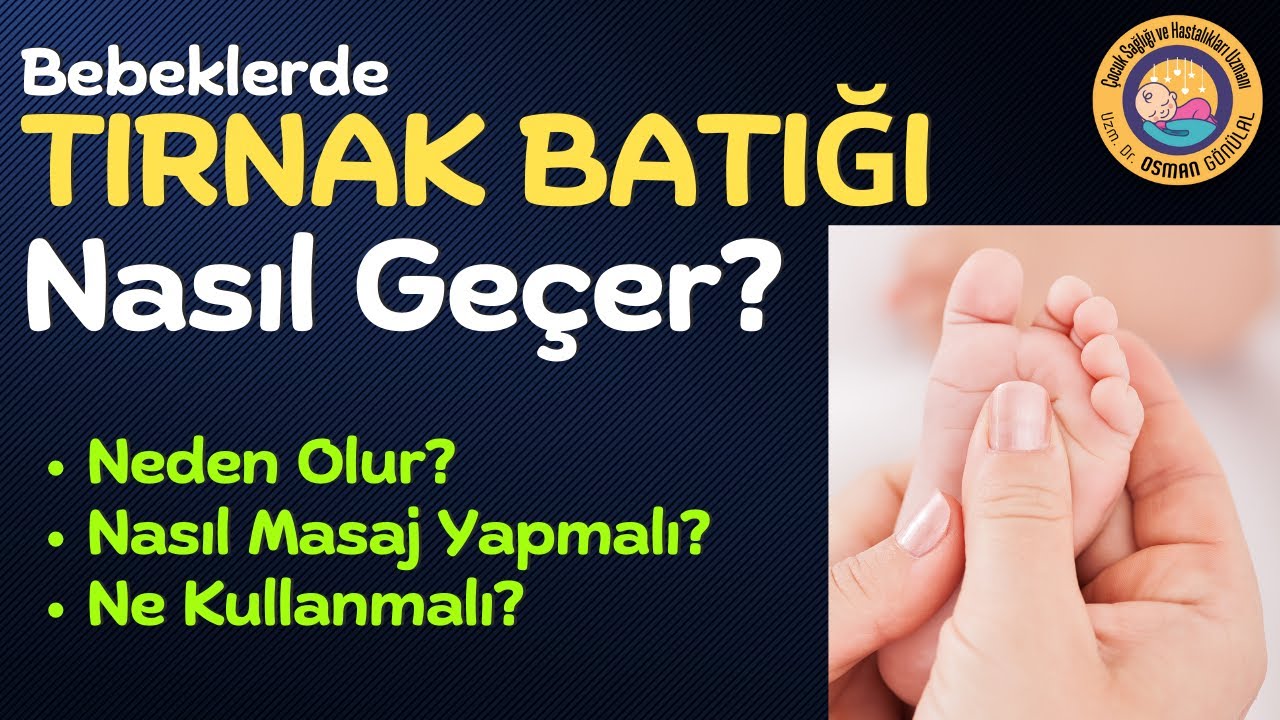 Bebeklerde Tırnak Batığı Nasıl &Ouml;nlenir? Nasıl Masaj Yapmalı?