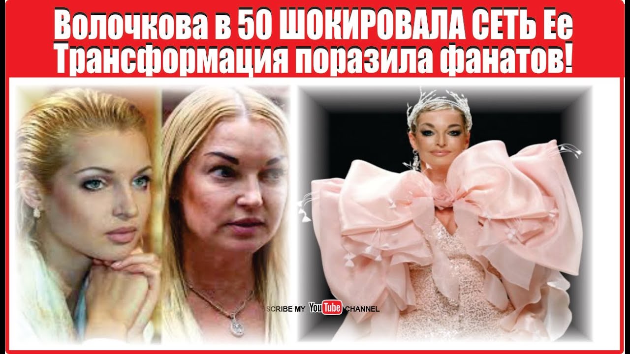 Волочкова в 50 ШОКИРОВАЛА СЕТЬ Ее трансформация поразила фанатов!