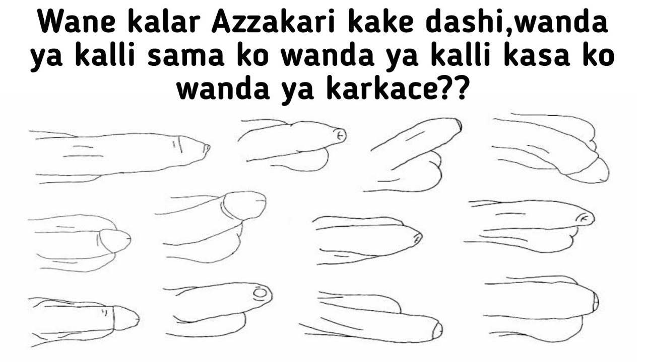 Matsayin Azzakarin daya kalli sama,koya kalli kasa ko wanda ya karkace! wanne ne yake da matsala?,