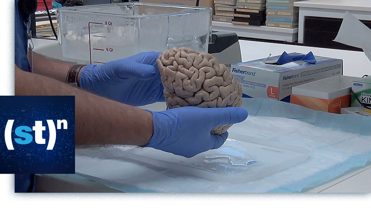 Autism Brain Net | SciTech Now