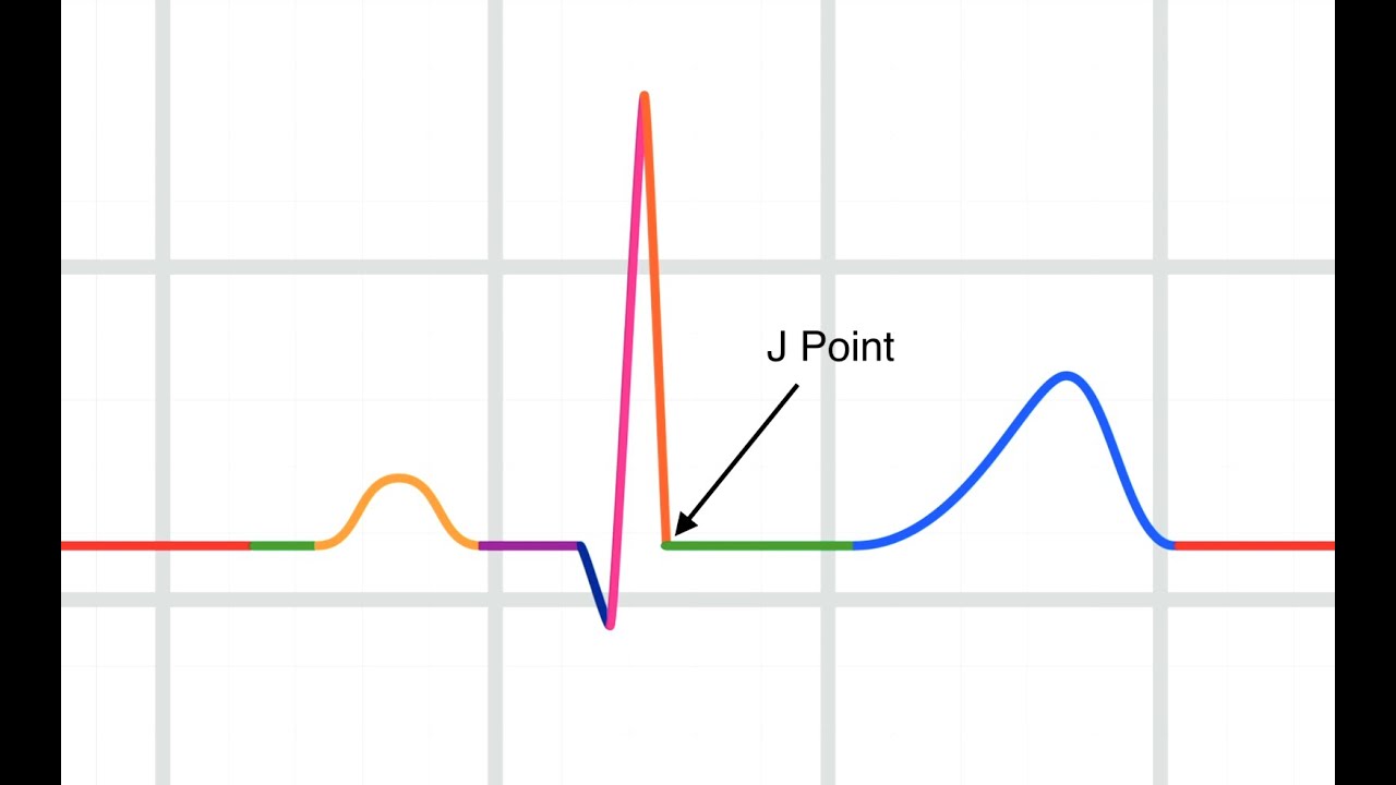 J point or J junction in Electrocardiography ; Definition, Characteristics, Meaning and Significance