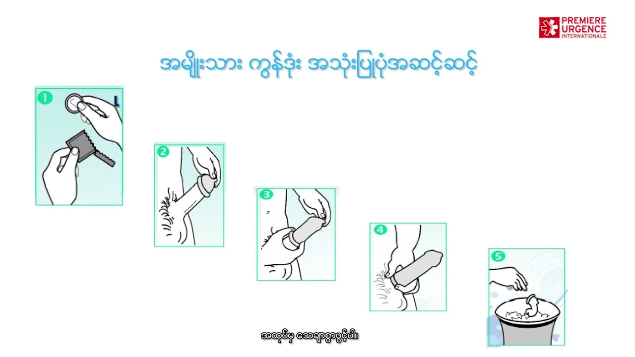 ကွန်ဒုံးအသုံးပြုခြင်း ရေတို(ကာလတို)သားဆက်ခြားနည်းလမ်း