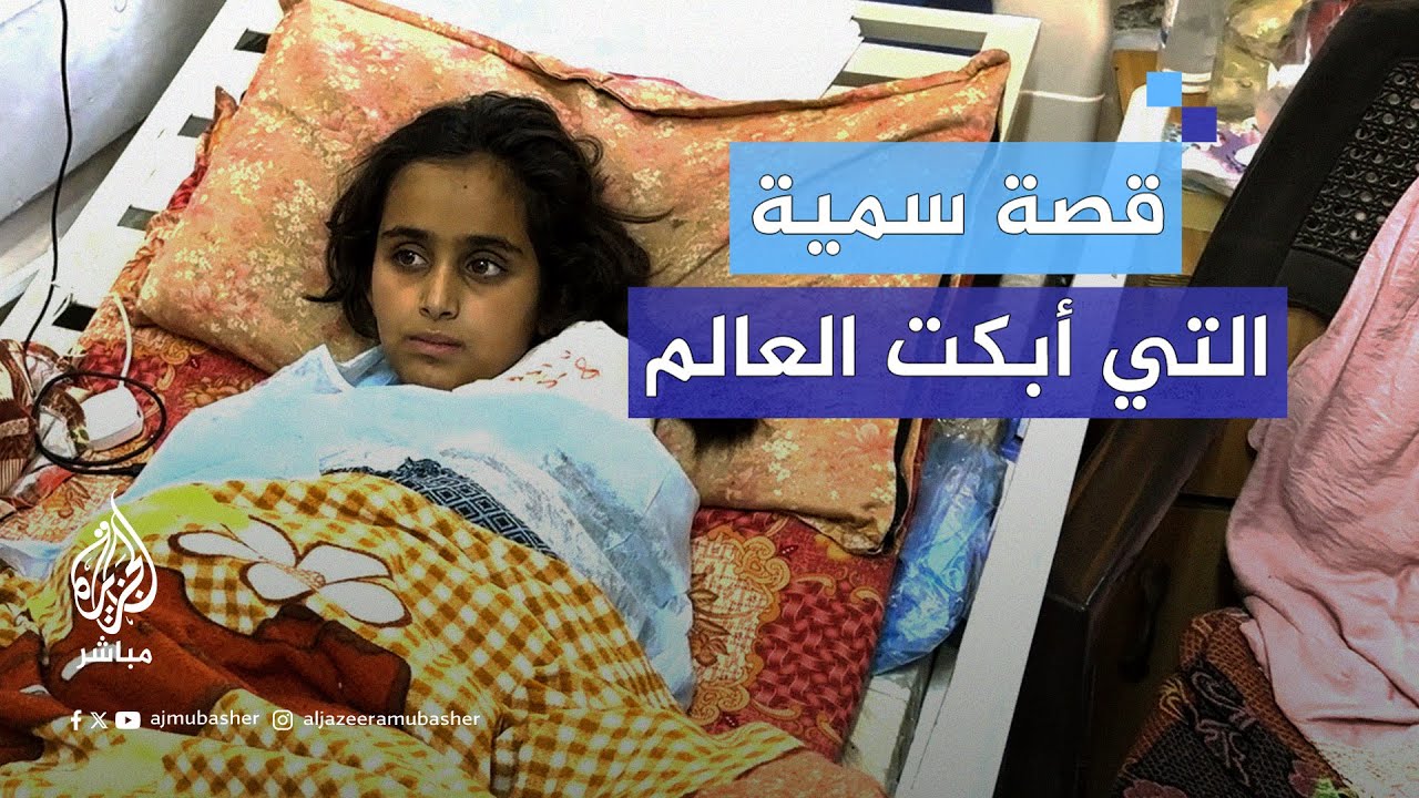 ما قصة الطفلة الفلسطينية سمية صاحبة اليد المبتـورة؟
