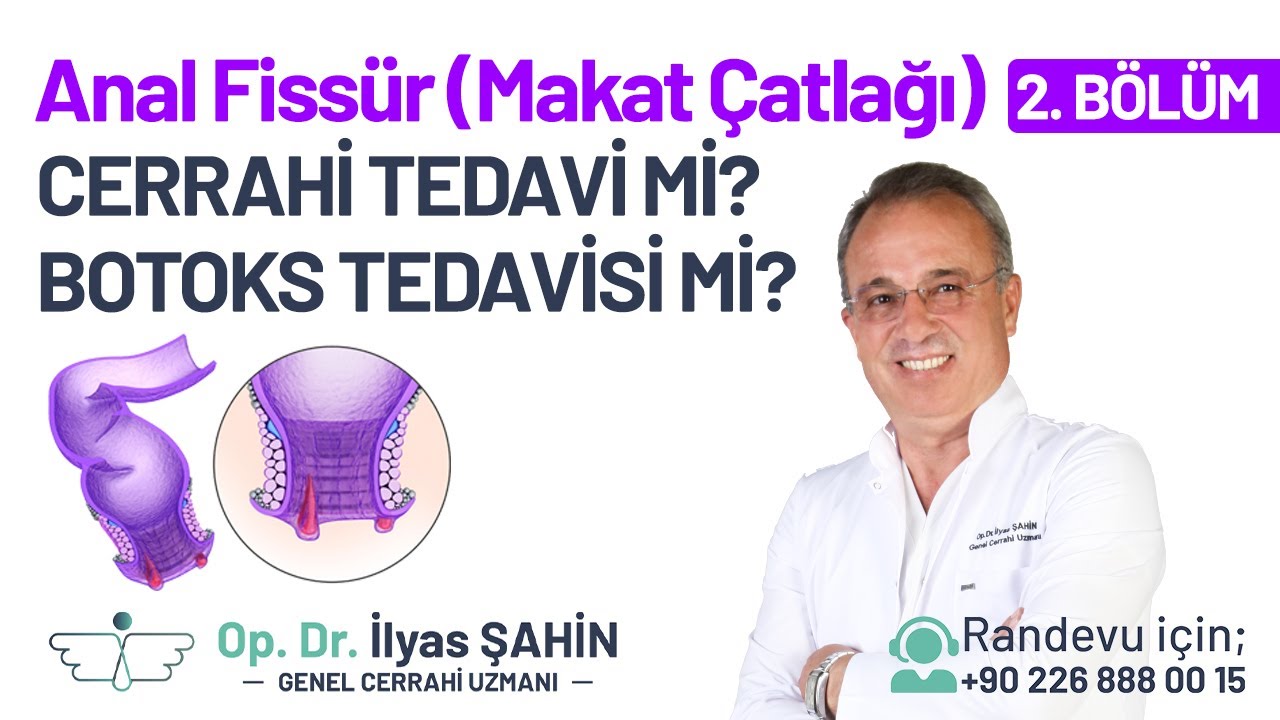 ANAL FİSSÜR (MAKAT ÇATLAĞI) TEDAVİ YÖNTEMLERİ-CERRAHİ TEDAVİ-BOTOKS UYGULMASI