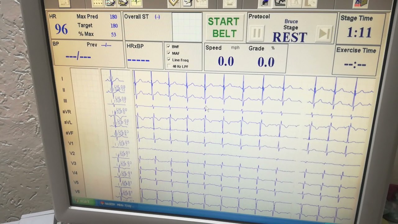 Quinton Q-Stress TM55