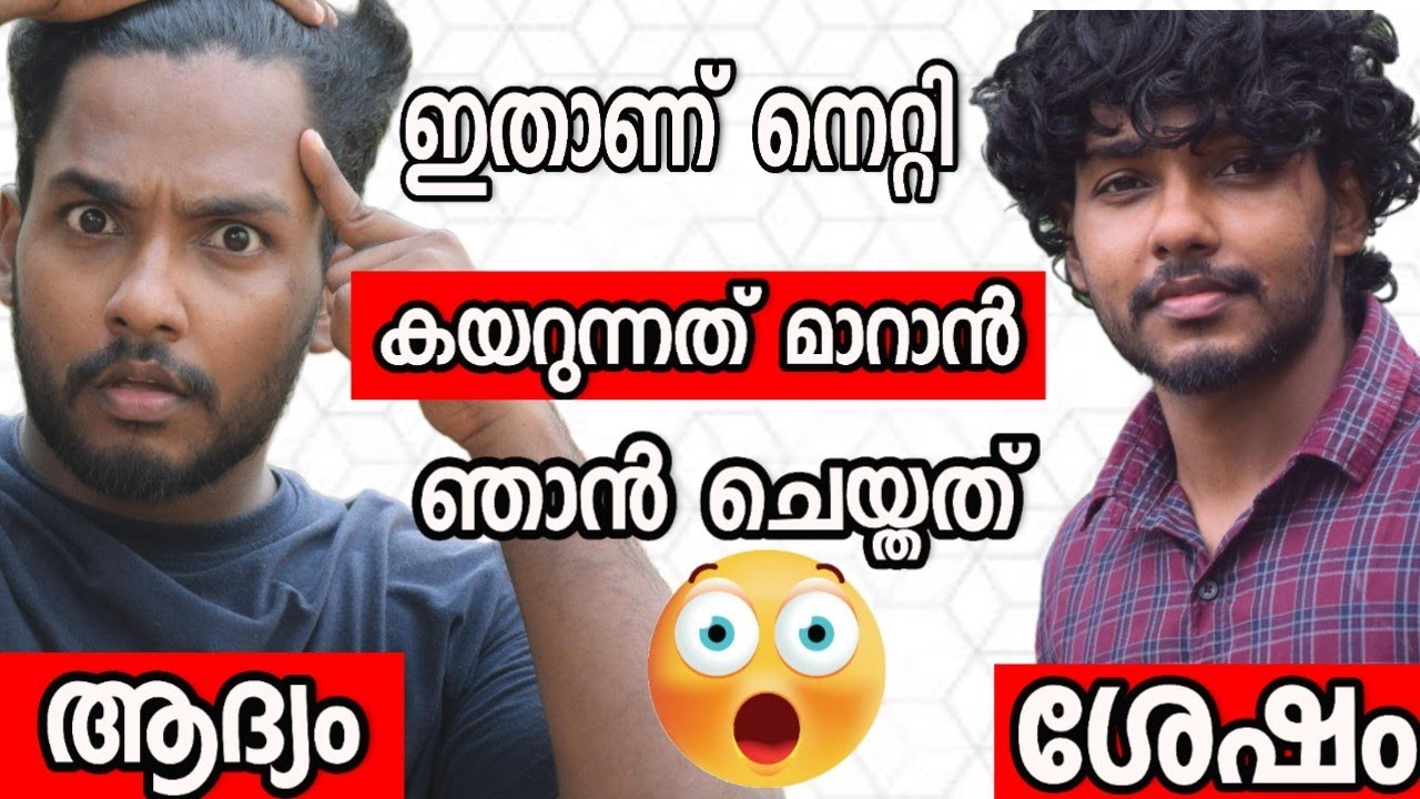 മൊട്ട തലയിൽ പോലും മുടി വരാൻ ഏറ്റവും എളുപ്പ വഴി @MaLLuUnToLD