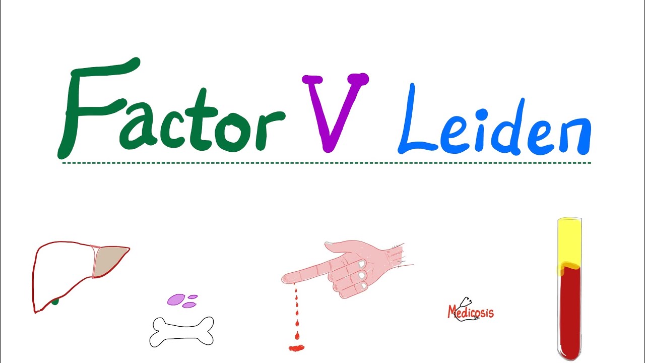 Factor V Leiden - Hypercoagulability - Bleeding and Coagulation Disorders - Hematology