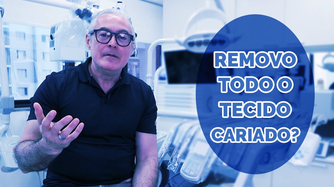 Remo&ccedil;&atilde;o Seletiva do Tecido Cariado.