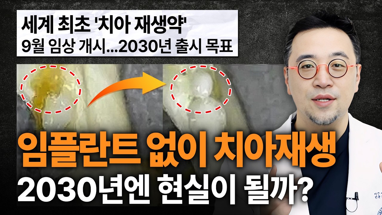 임플란트 대체할 '치아 재생약', 상용화 가능할까?